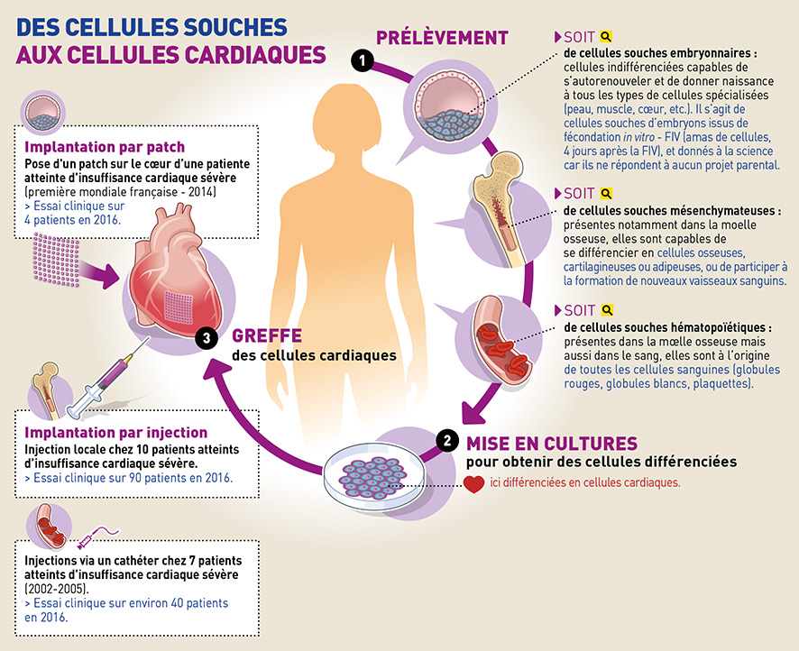 Adipose Stem Cells