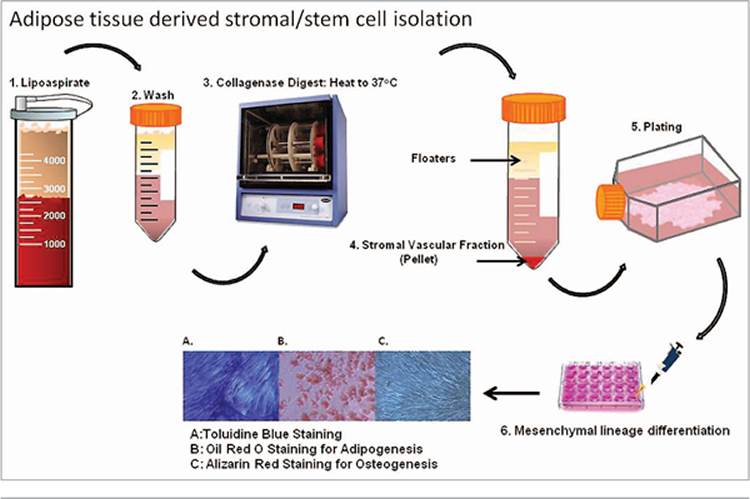 Adipose Stem Cells